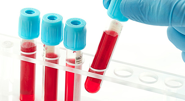 биохимический анализ крови при панкреатите
